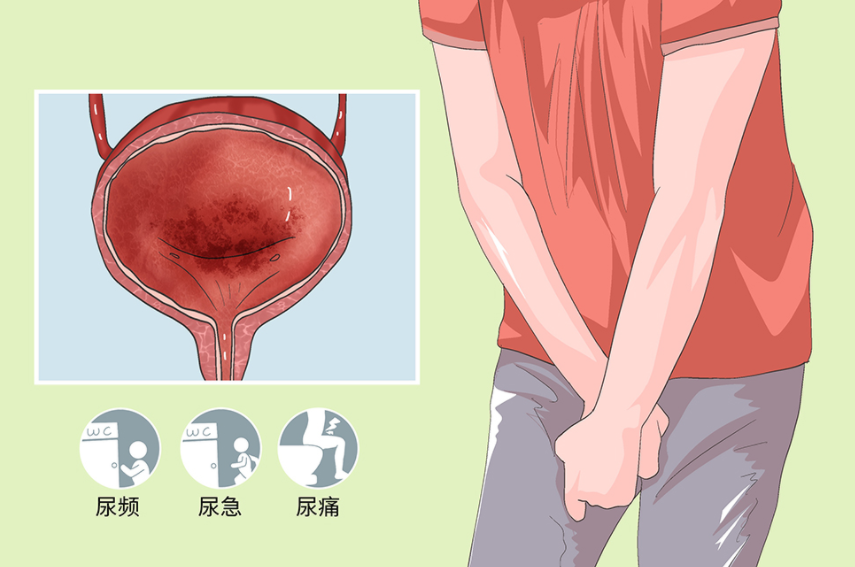 83d22dbadef5151f628a781d89e523ee.png